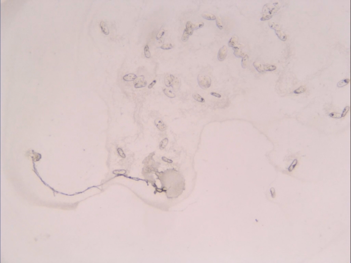 Zornio eva parameciums death still cahiers dartistes pro helvetia